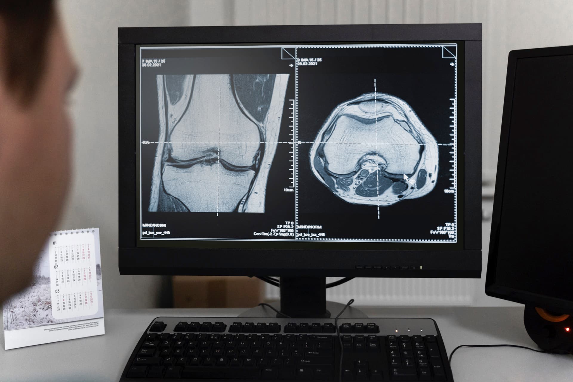 Clinician reviewing imaging scans on a workstation